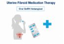 자궁근종 약물치료, 임시방편일까? 최신 연구로 본 효과와 한계